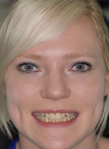 New Patients New Patients | Jacaranda Dental
