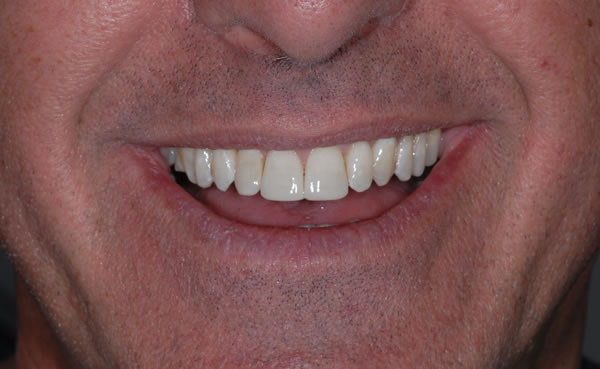 Services Services | Jacaranda Dental