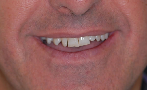 Services Services | Jacaranda Dental