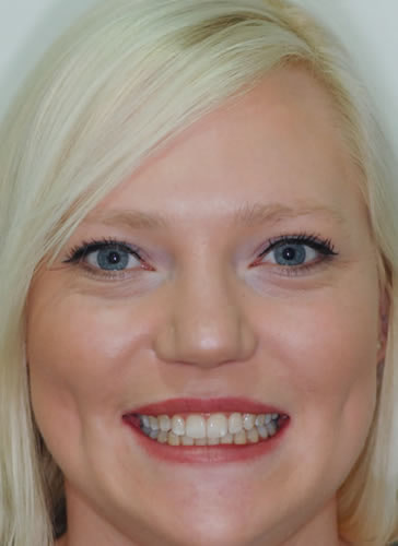 Services Services | Jacaranda Dental