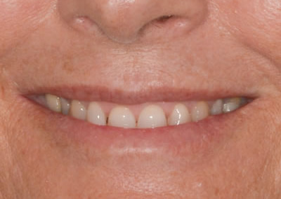 Dental Treatments | Jacaranda Dental