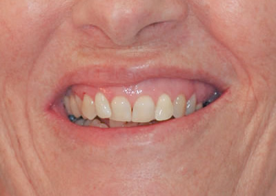 Dental Treatments | Jacaranda Dental