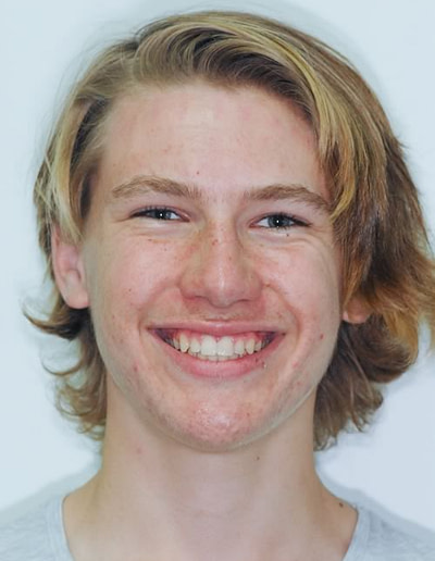 Orthodontics Orthodontics | Jacaranda Dental