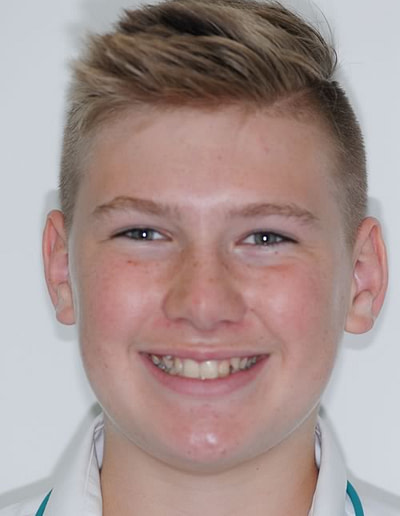 Orthodontics Orthodontics | Jacaranda Dental