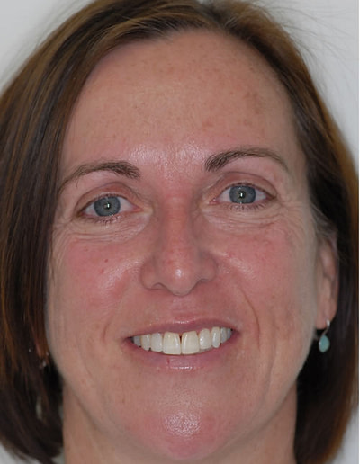 Orthodontics Orthodontics | Jacaranda Dental