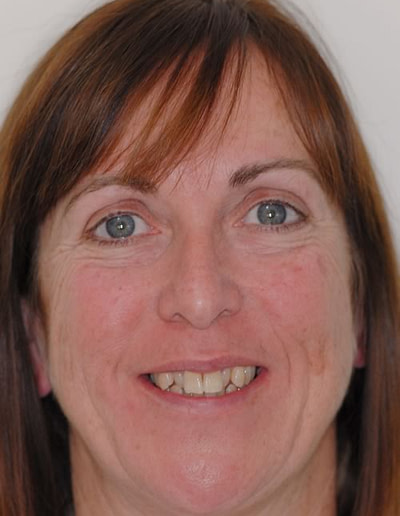 Orthodontics Orthodontics | Jacaranda Dental