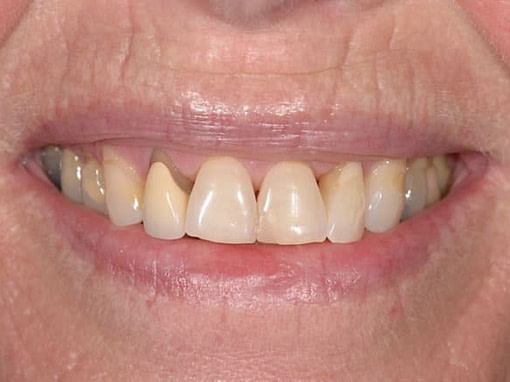 Cosmetic Dentistry Cosmetic Dentistry | Jacaranda Dental