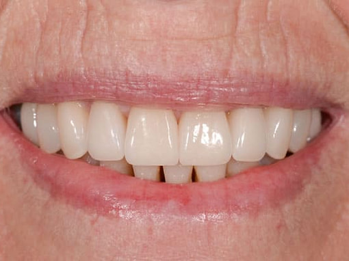 Cosmetic Dentistry Cosmetic Dentistry | Jacaranda Dental