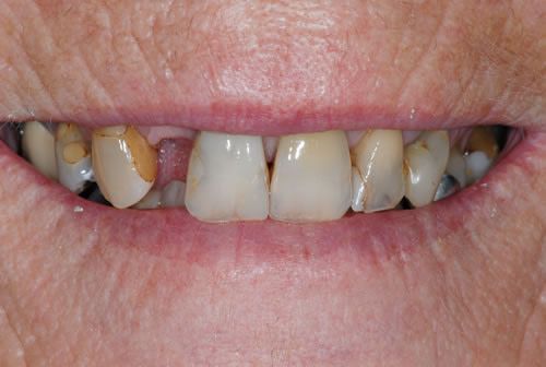 Cosmetic Dentistry Cosmetic Dentistry | Jacaranda Dental