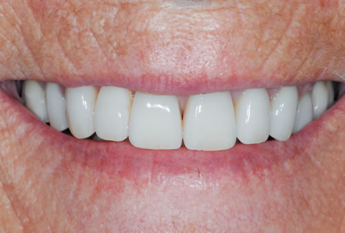 Cosmetic Dentistry Cosmetic Dentistry | Jacaranda Dental