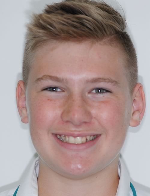 Braces - Orthodontics Braces - Orthodontics | Jacaranda Dental