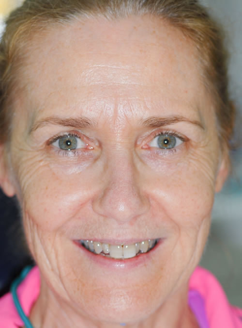 Cosmetic Dentistry Cosmetic Dentistry | Jacaranda Dental