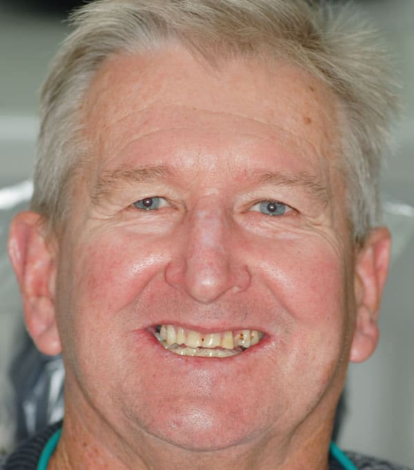 Services | Jacaranda Dental