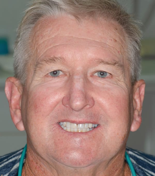 Services | Jacaranda Dental